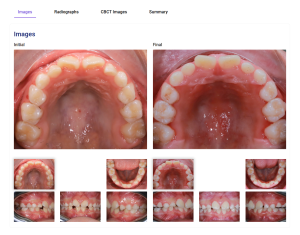 ca-dieu-tri-thu-10-tren-global-align-gallery