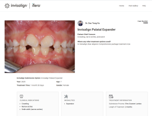 ca-dieu-tri-thu-10-tren-global-align-gallery