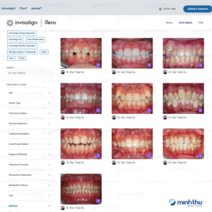 ca-dieu-tri-tren-global-align-gallery-cua-bac-si-vu-duc-tung