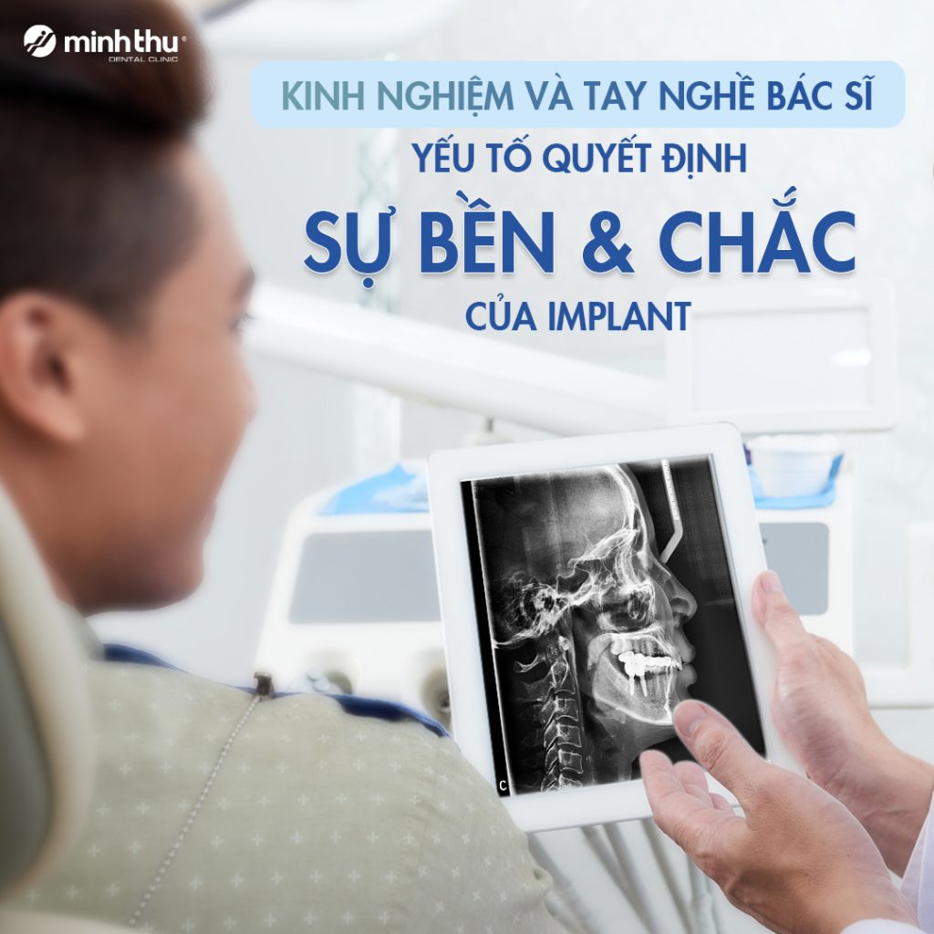 cay-ghep-implant-nha-khoa-minh-thu