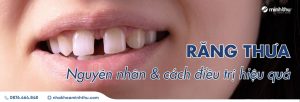 rang-bi-thua-nguyen-nhan-giai-phap
