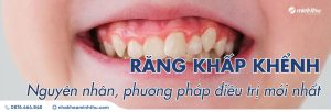 rang-khap-khenh-nguyen-nhan-phuong-phap-dieu-tri