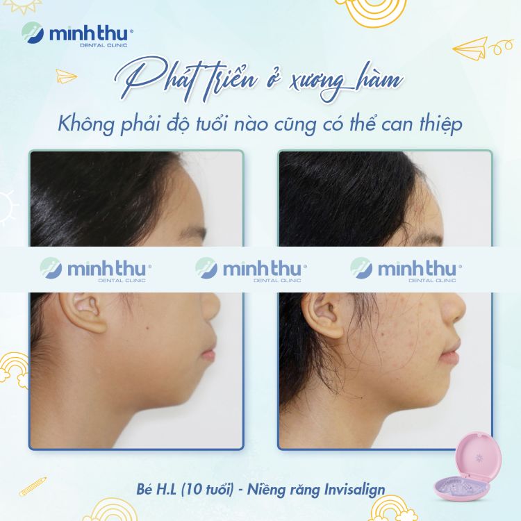 nieng-rang-som-khach-hang