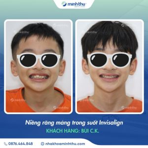 nieng-rang-som-khach-hang
