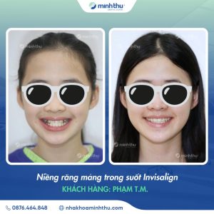 nieng-rang-som-khach-hang