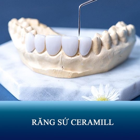 răng sứ ceramill