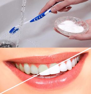 tẩy trắng răng tại nha